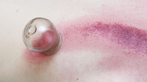 前列腺痛的物理療法有哪些 介紹幾種常見的物理治療方法