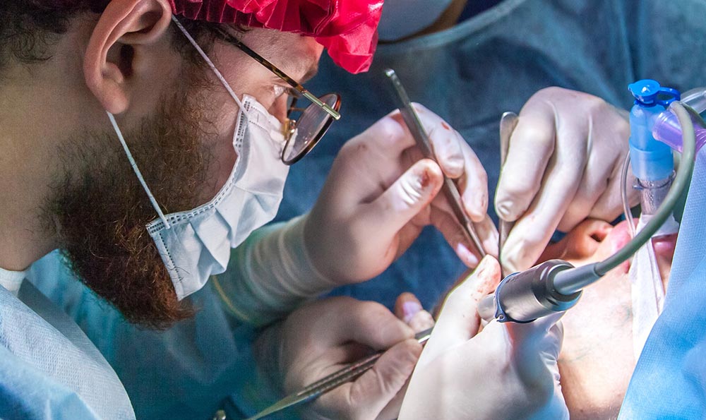 駝峰鼻矯正術(shù)效果