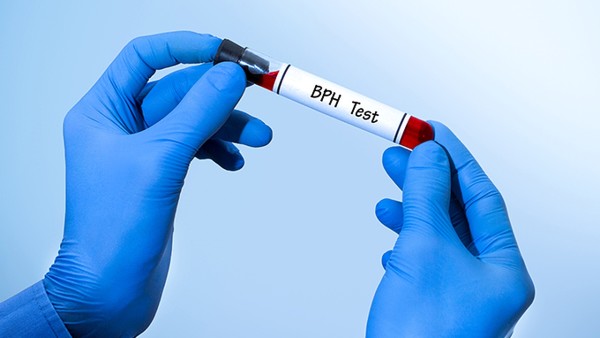 前列腺液檢查的相關(guān)問題