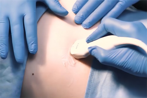 醫(yī)用超聲耦合劑與潤滑劑的差別：用途與效果的比較